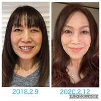 マイナス７歳の顔を自分で手に入れる顔ヨガ